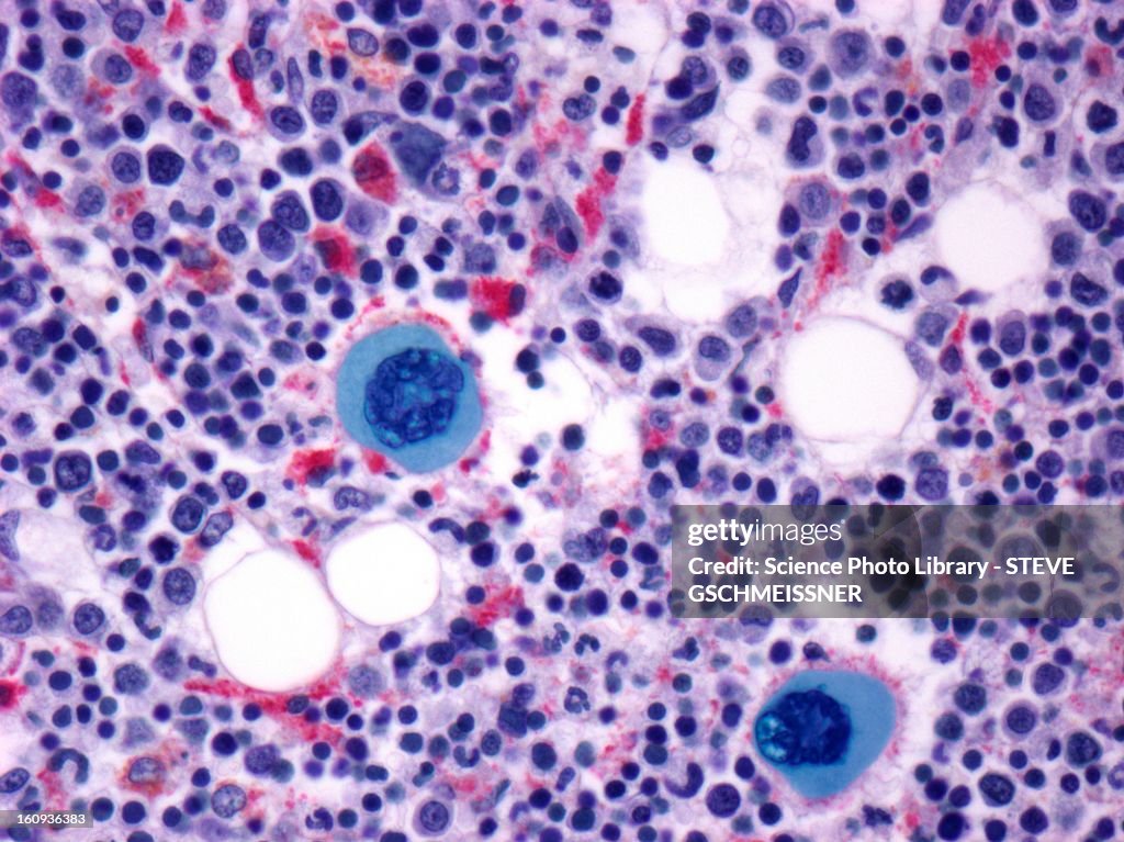 Bone marrow, light micrograph