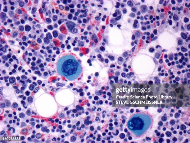 bone marrow, light micrograph - bone marrow stock illustrations