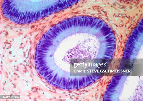 Epididymis, light micrograph Epididymis, light micrograph