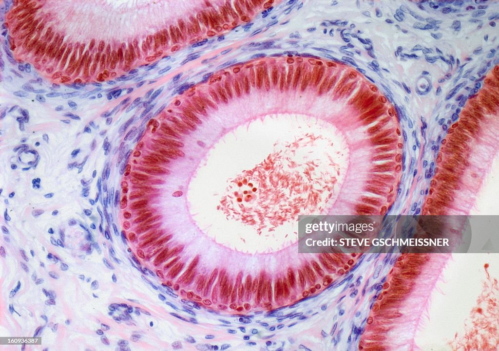 Epididymis, light micrograph