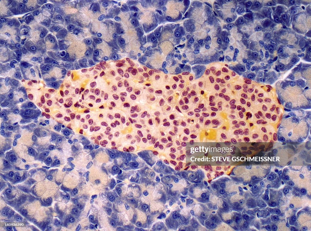 Islet of Langerhans, light micrograph
