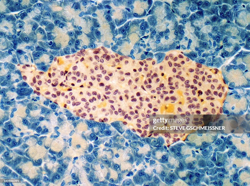 Islet of Langerhans, light micrograph