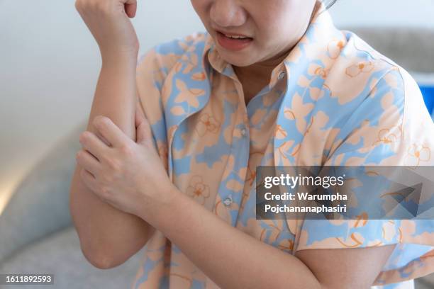 asian woman scratching her arm, itching from allergies, skin disease. - stinging stock pictures, royalty-free photos & images