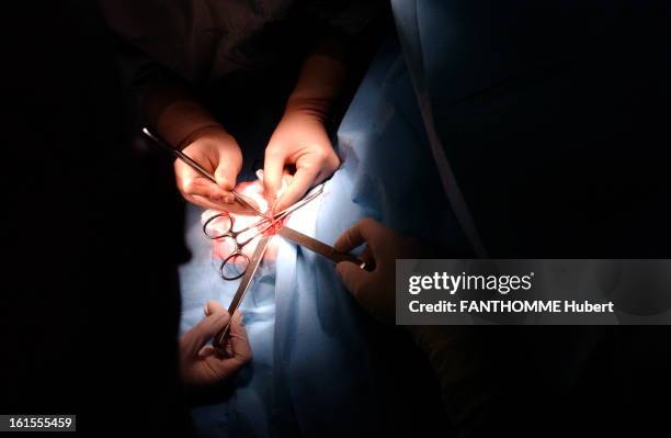 Healing The Fetus. Focus on the hands of Dr. Sylvie BEAUDOUIN the hospital Saint-Vincent-de-Paul PARIS, practicing colon resection in a baby 5 days.