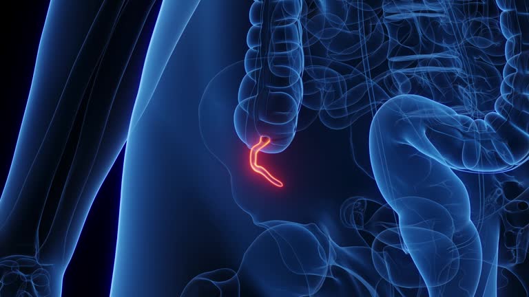 Animated Appendix 65 Appendix Organ Stock Videos, Footage, & 4K Video Clips - Getty Images