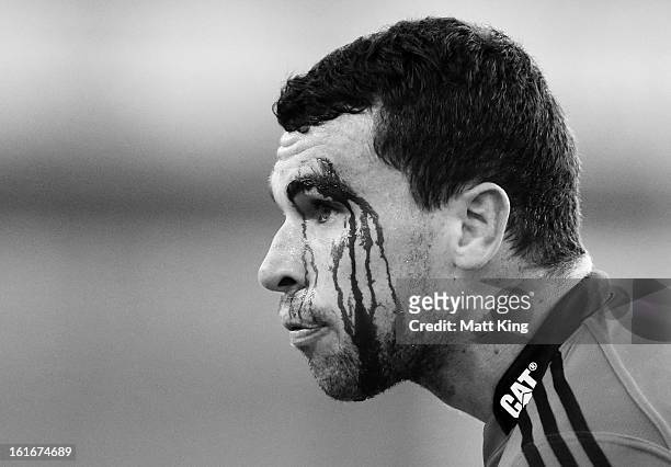 Tom Marshall of the Crusaders is treated for a cut to the head during the Super Rugby trial match between the Waratahs and the Crusaders at Allianz...