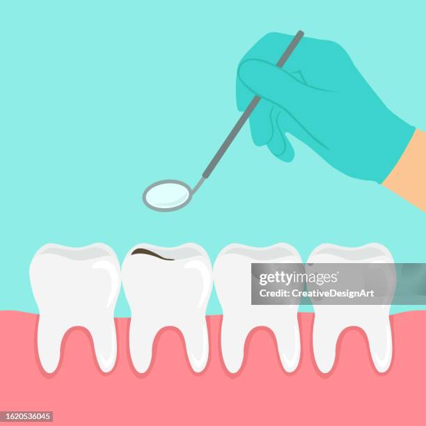 hand des zahnarztes, die einen abgewinkelten spiegel hält und zähne untersucht. zahn mit karies. konzept der zahngesundheit - root canal procedure stock-grafiken, -clipart, -cartoons und -symbole