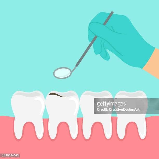 dentist's hand holding angled mirror and examining teeth. tooth with decay. dental health concept - dental filling stock illustrations