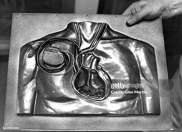 First Battery Operated Pacemaker 20 Pacemaker Battery Stock Photos, High-Res Pictures, and Images ...