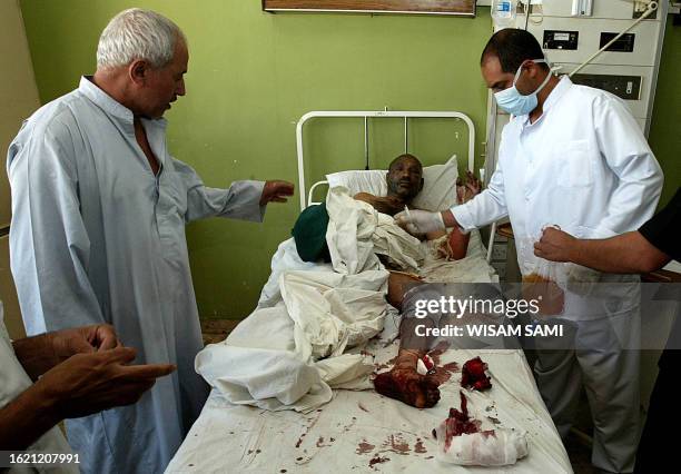 An Iraqi medic treats a wounded civilian at a local hospital in Baghdad 31 May 2006. The civilian was injured when a bomb exploded in a crowded...