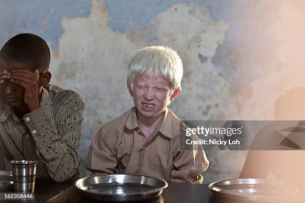 An albino visually impaired student waits for lunch at the Government High School for The Blind on February 22, 2013 in Kadapa, India. The school...