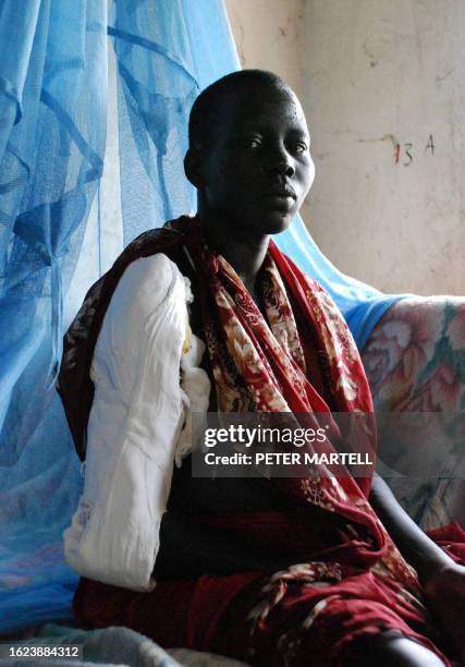 Year old southern Sudanese woman recovers at Akobo's hospital from a gunshot wound to her arm and a spear thrust in her back, in Sudan's Jonglei...