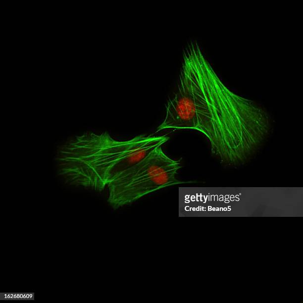inmunofluorescencia microscopía - célula cultivada fotografías e imágenes de stock