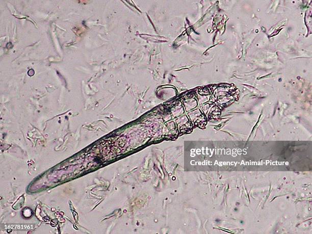 Demodex mite in the institute for parasitology of the Ludwig-Maximilians-University Munich on November 26, 2003 in Munich, Germany.