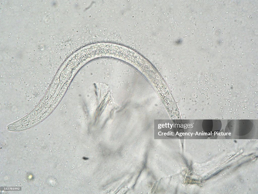 Parasites