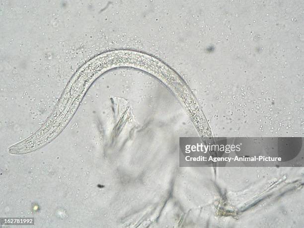 Larva of a hookworm of a dog in the institute for parasitology of the Ludwig-Maximilians-University Munich on November 26, 2003 in Munich, Germany.