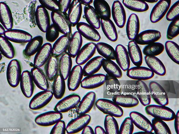 Pin Worms Examples Pinworm in the institute for parasitology of the... News Photo - Getty ...