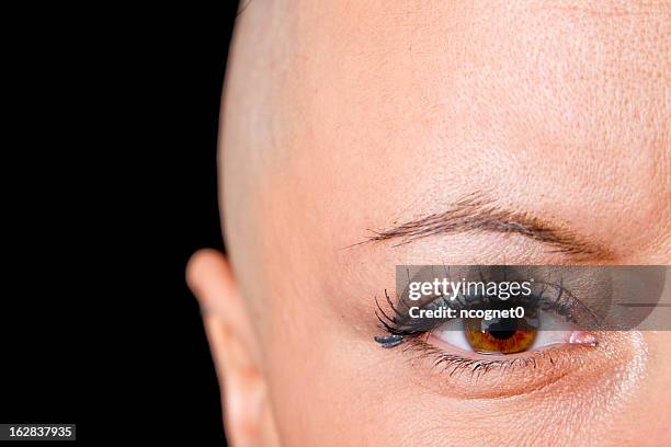 a bald woman who is a cancer survivor - chemotherapy stock pictures, royalty-free photos & images