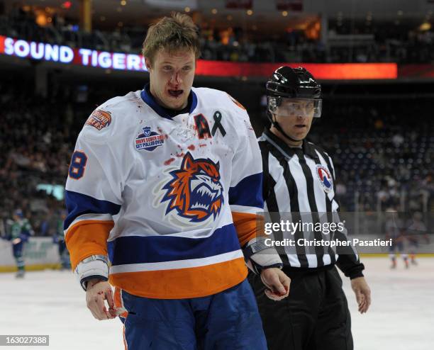 Nathan McIver of the Bridgeport Sound Tigers skates off the ice after breaking his nose in a fight during an American Hockey League game against the...