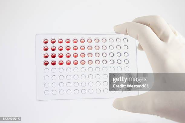germany, bavaria, munich, scientist researching blood in laboratory - prateleira de tubos de ensaio imagens e fotografias de stock