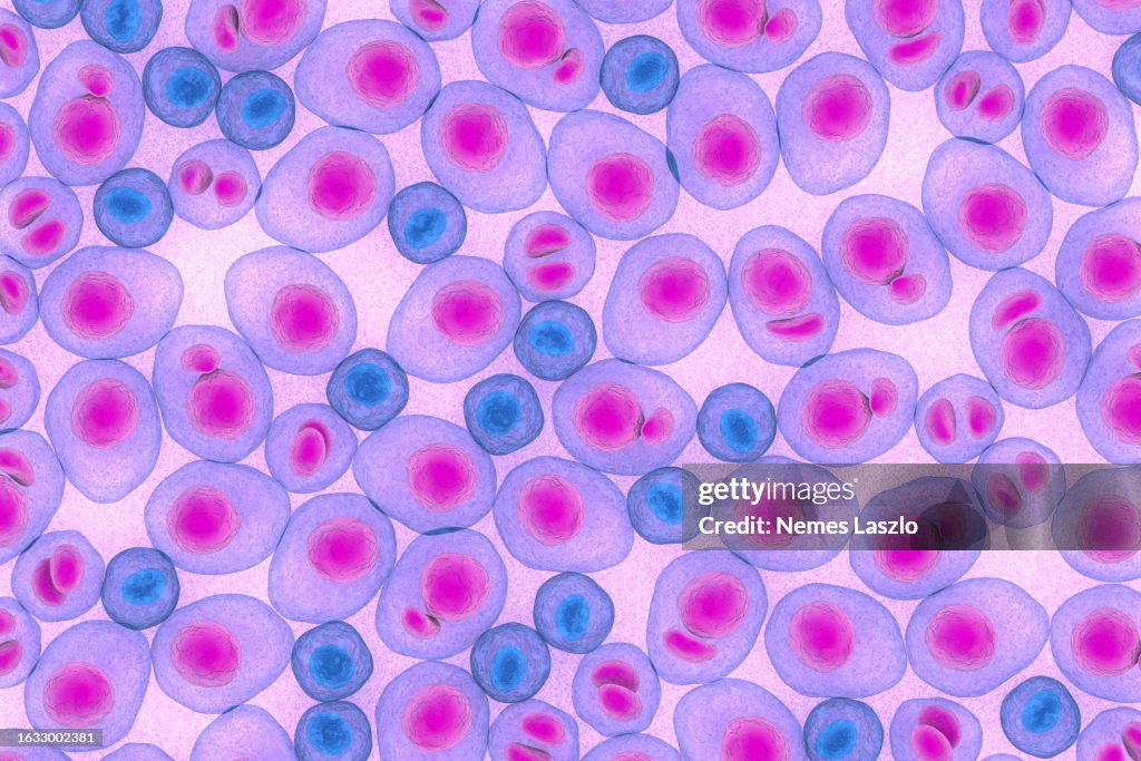 Aml Cancer Color Myeloma Multiplex Leukemia Cancer 3d Color Render Illustration High-Res ...