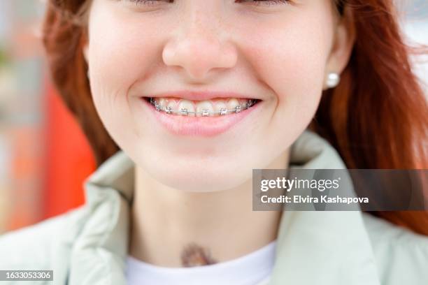 smiling red-haired teenage girl in braces, close-up - voronezh stock pictures, royalty-free photos & images