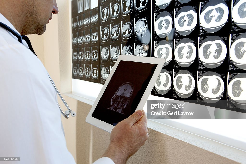 Doctor examining MRI scans