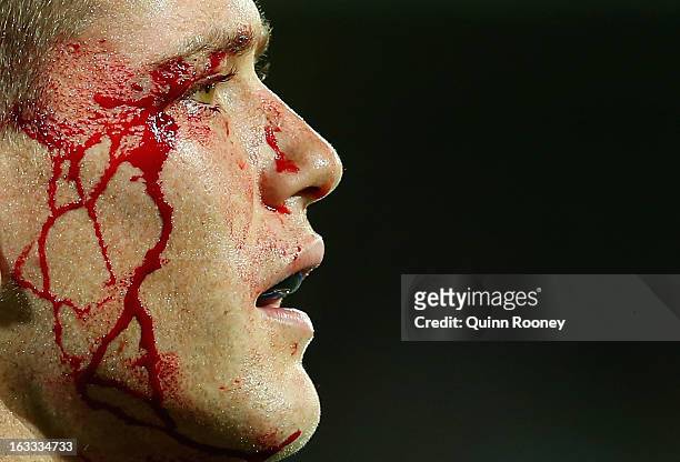 Rory Sidey of the Rebels bleeds from the eye during the round 4 Super Rugby match between the Rebels and the Reds at AAMI Park on March 8, 2013 in...