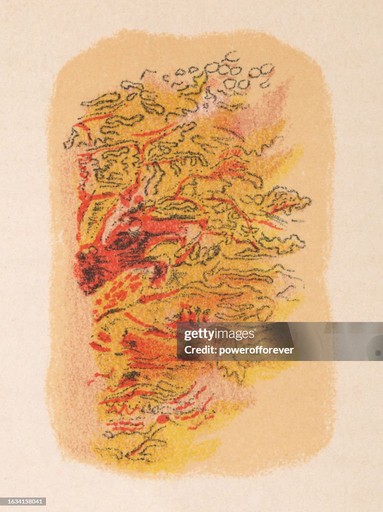 Medical Illustration of Human Skin with Varicose Eczema (Stasis Dermatitis) - 19th Century