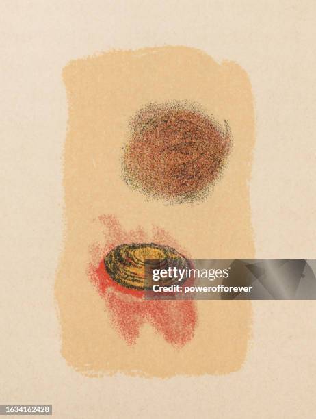 ilustrações de stock, clip art, desenhos animados e ícones de medical illustration of human skin with rupioid plaque psoriasis (psoriasis vulgaris) - 19th century - autoimmunity