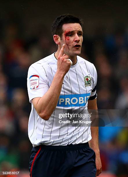 Scott Dann of Blackburn Rovers suggest an elbow was raised during the FA Cup sponsored by Budweiser sixth round match between Millwall and Blackburn...