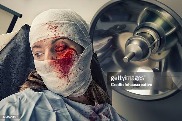 torture victim in shock from loosing an eye - female torture stock pictures, royalty-free photos & images