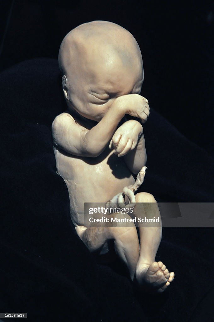 A plastinated human baby is on display during a press conference for
