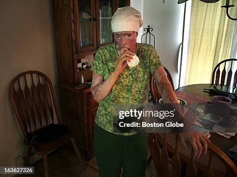 Carmen Tarleton stands at her kitchen table of her home.Two tears ago she was attacked by her estranged husband when he broke into the home at night,...