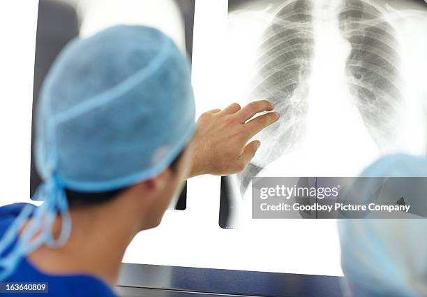 look closely over here... - human rib cage stock pictures, royalty-free photos & images