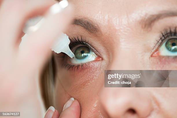 woman usind eyedropper...applying eye drops - eyes stockfoto's en -beelden