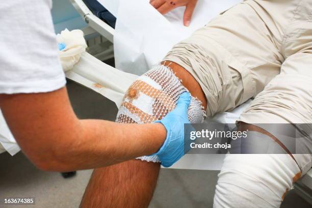 krankenschwester kümmert sich um patienten mit den verletzten knie - wunde stock-fotos und bilder