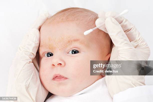 medical examination at a baby - seborrheic dermatitis stock pictures, royalty-free photos & images