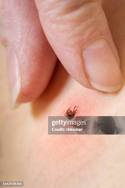 biting tick infected with lyme disease - steken-dierlijk-gedrag stockfoto's en -beelden