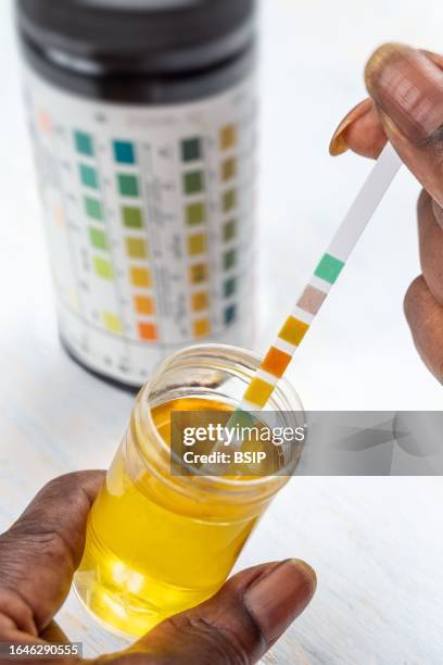 urine self-tests-self-measurement - bilirubina foto e immagini stock