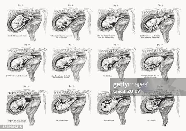 ilustraciones, imágenes clip art, dibujos animados e iconos de stock de posiciones anormales de fetos equinos, grabado en madera, publicado en 1898 - placenta