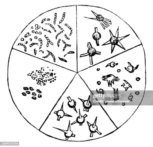 microscopic view of various urate crystalluria (crystals) in human urine - 19th century - ammonium biurate stock illustrations