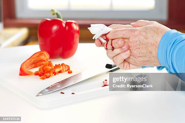 kitchen accident with knife and blood - hand laceration stockfoto's en -beelden