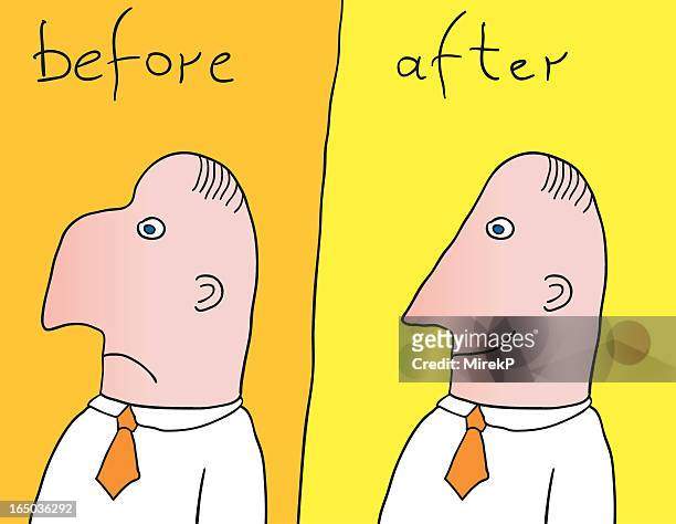 before &amp; after - plastic surgery stock illustrations