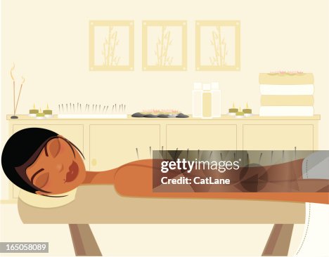 Acupuncture Acupuncture