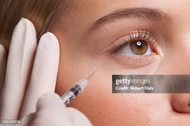 nahaufnahme von frau empfangende botox-spritze im auge - schönheitsoperation stock-fotos und bilder
