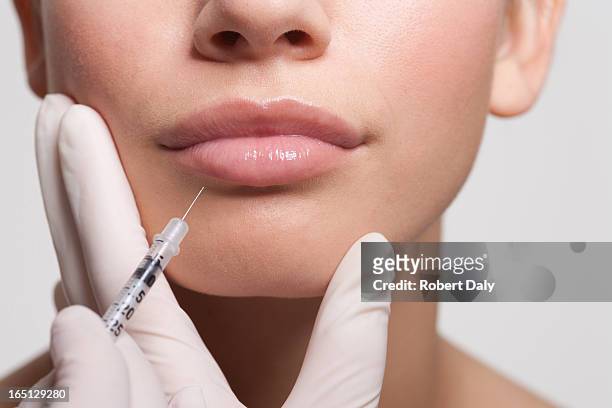 primo piano di donna ricevendo iniezione di botox nelle labbra - chirurgia estetica donna foto e immagini stock