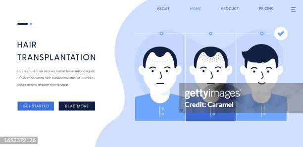 illustrazioni stock, clip art, cartoni animati e icone di tendenza di illustrazione del trapianto di capelli per il modello di pagina di destinazione - fusto del pelo