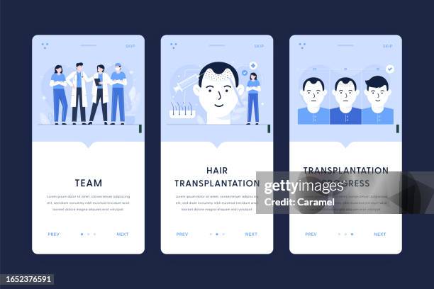 medical team, hair transplantation, transplantation process illustrations. user onboarding templates for mobile apps - nurses working together stock illustrations
