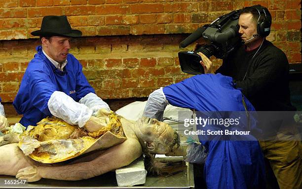 Professor Gunther Von Hagens performs an autopsy November 20, 2002 in London, England. The first public dissection of a human body in over 170 years...